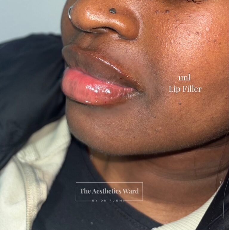 Instagram post from the.aestheticsward. This post is in position 4.