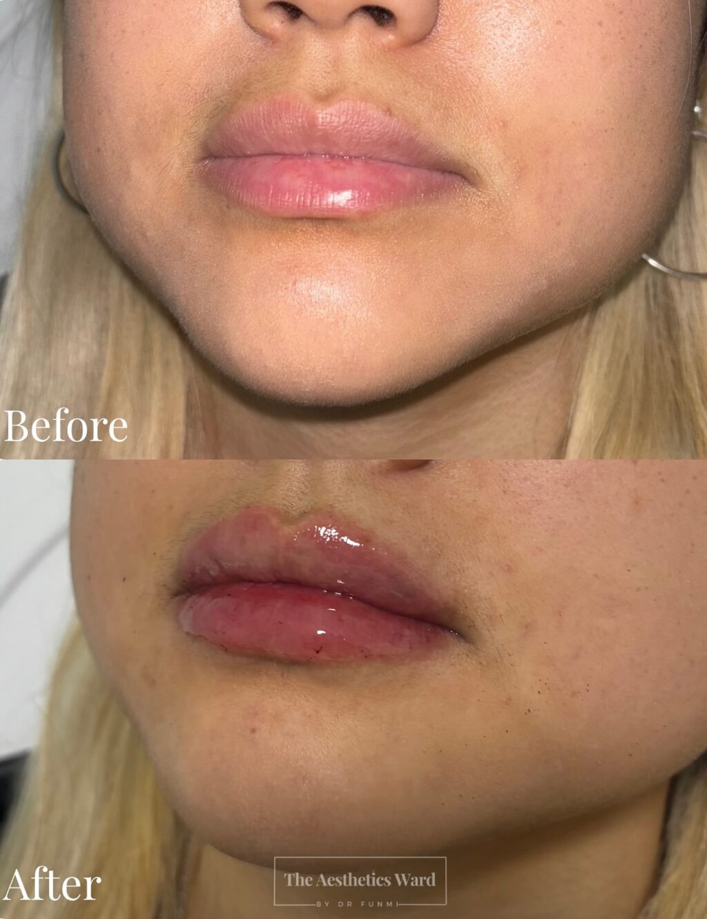 Instagram post from the.aestheticsward. This post is in position 7.