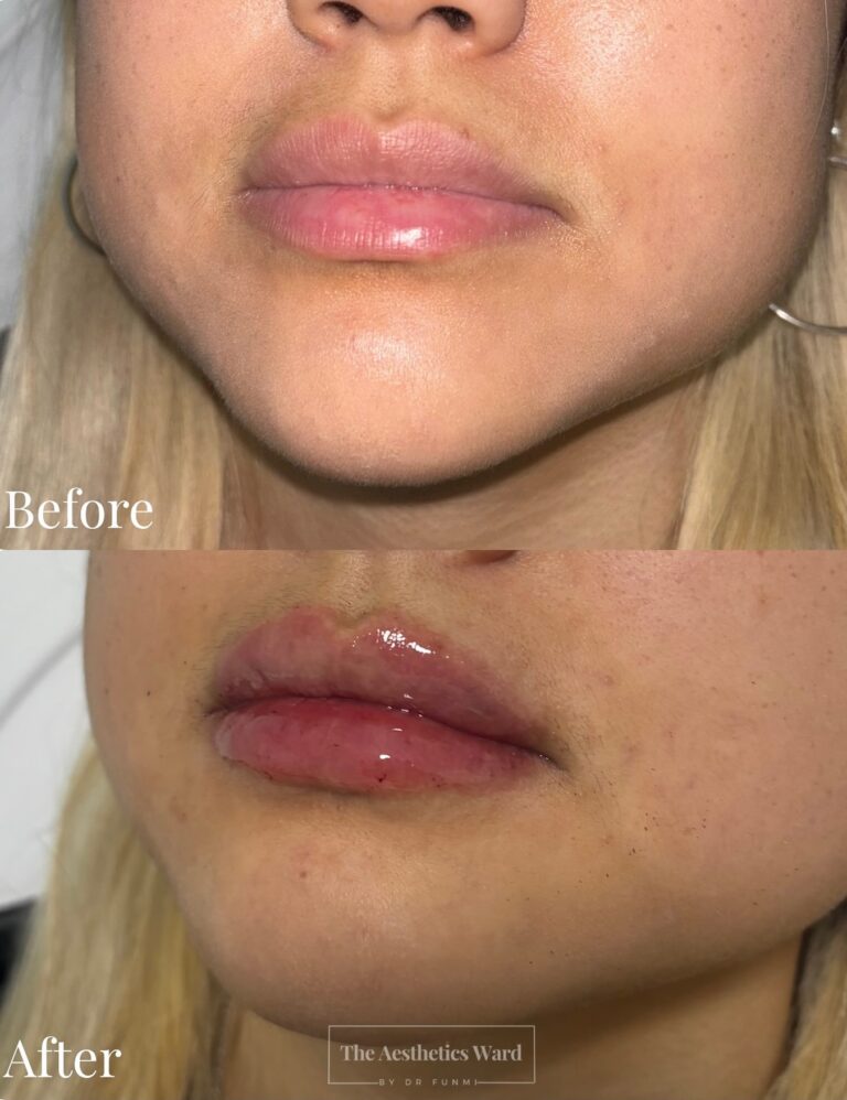 Instagram post from the.aestheticsward. This post is in position 8.