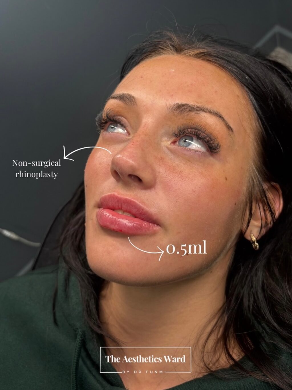 Instagram post from the.aestheticsward. This post is in position 1.