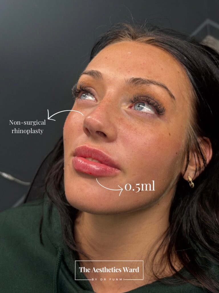 Instagram post from the.aestheticsward. This post is in position 2.