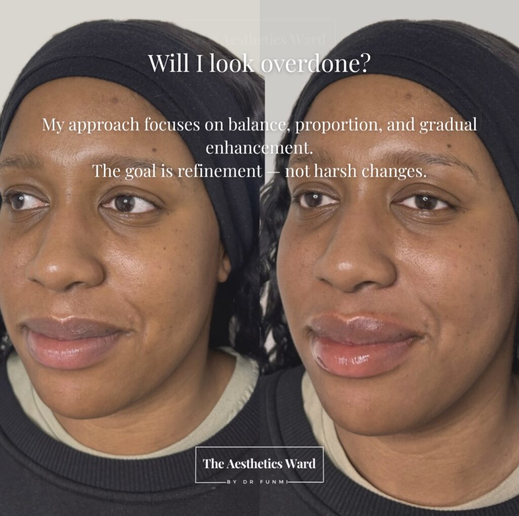 Instagram post from the.aestheticsward. This post is in position 3.