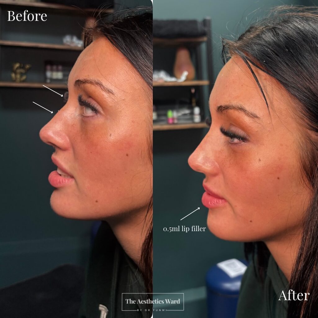 Instagram post from the.aestheticsward. This post is in position 5.