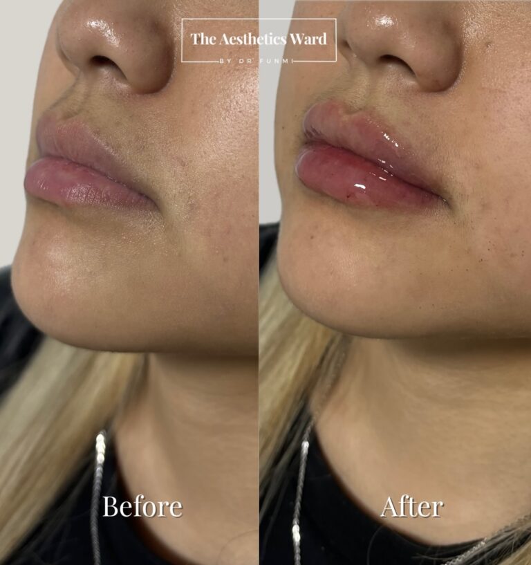 Instagram post from the.aestheticsward. This post is in position 5.