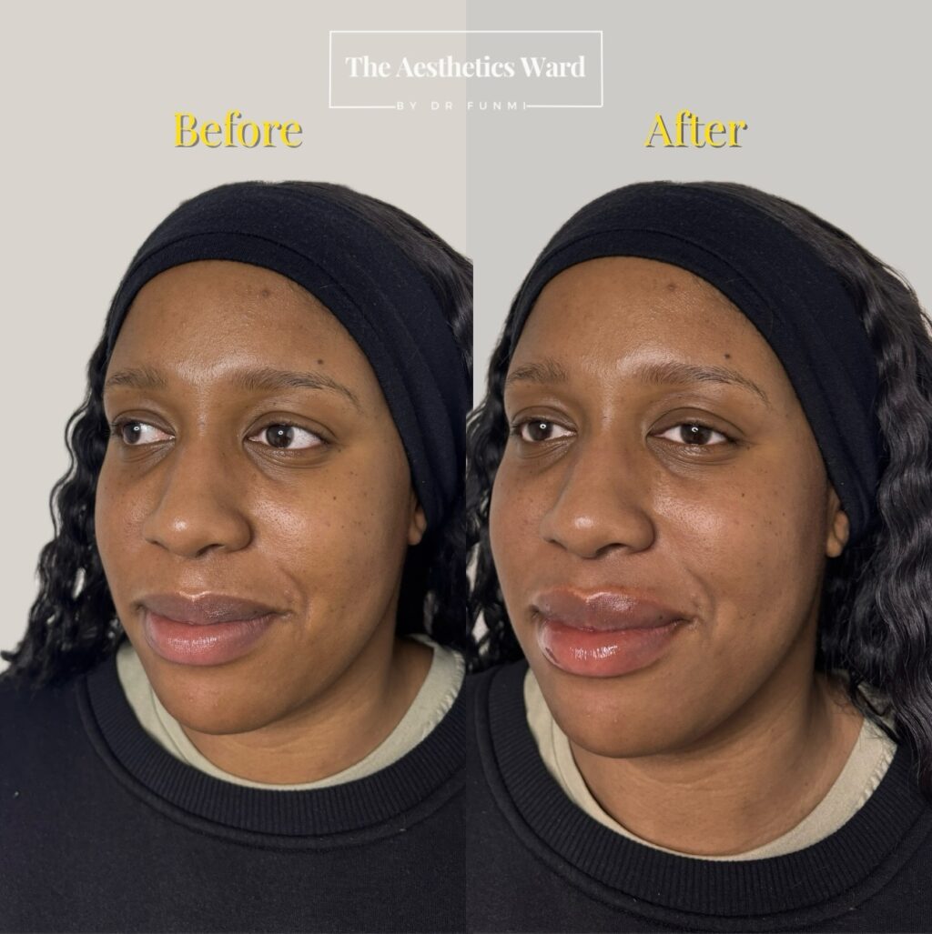 Instagram post from the.aestheticsward. This post is in position 0.