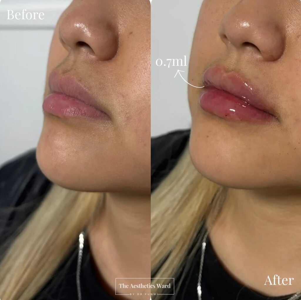 Instagram post from the.aestheticsward. This post is in position 0.