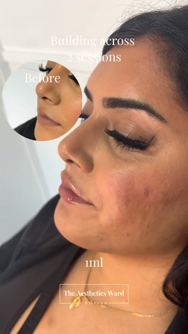 Instagram post from the.aestheticsward. This post is in position 2.